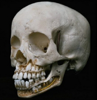 Sch�delknochen